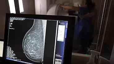 Cerca de 77 mil mulheres aguardam mamografia pelo SUS, diz relatório