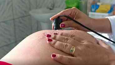 Brasil amplia assistência ao parto e pré-natal é desafio