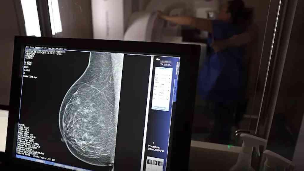 Escassez de mamógrafos dificulta prevenção do câncer de mama | Relatório mostra disparidades regionais e baixa cobertura no Brasil