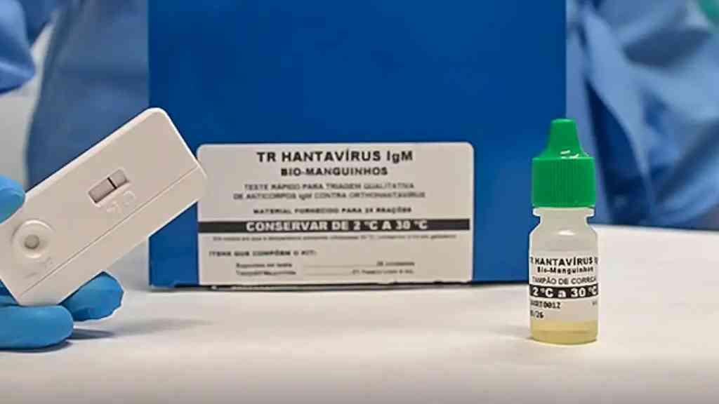 Novo exame oferece diagnóstico imediato da hantavirose | Produto desenvolvido pela Fiocruz e UFRJ obteve registro da Anvisa