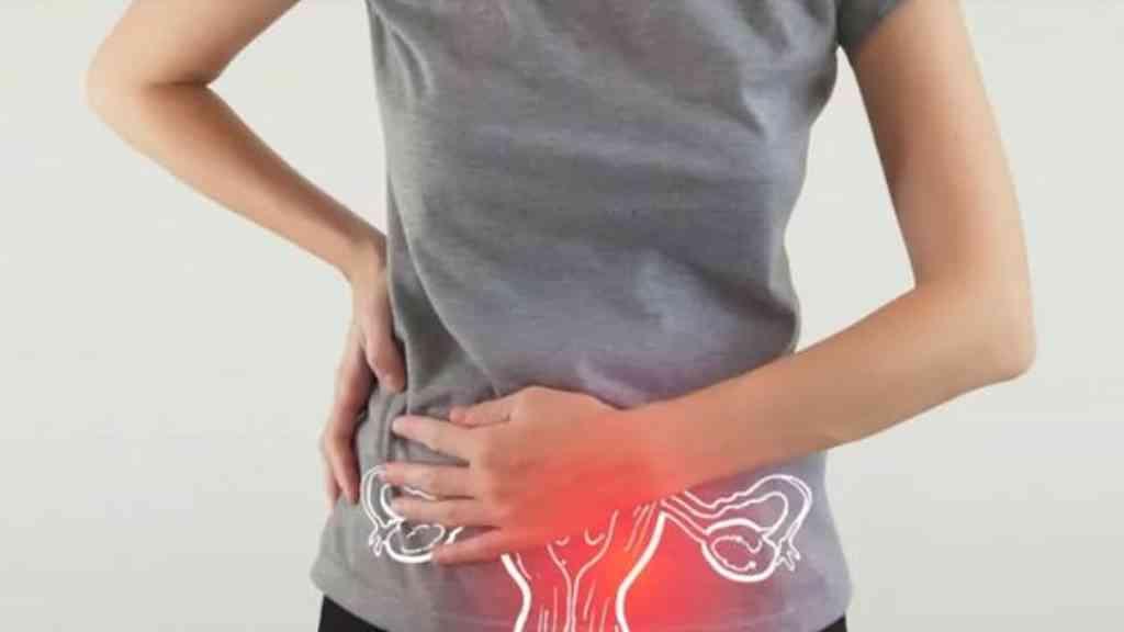 Endometriose afeta milhões de brasileiras, entenda | Endometriose impacta milhões de mulheres no país