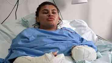 Jovem sobrevive a ataque brutal no Ceará