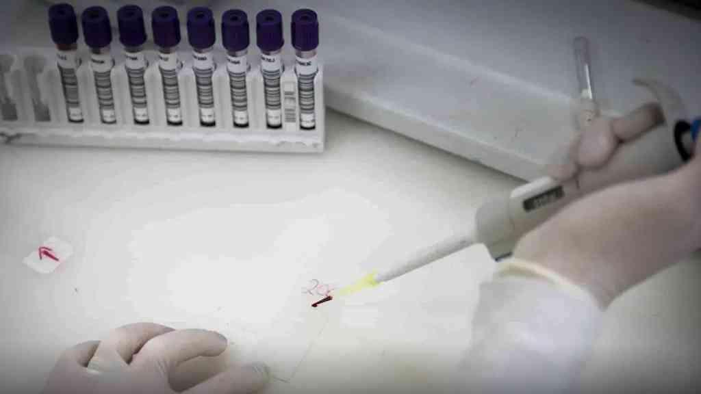 Paciente suspeito de ebola em SP tem diagnóstico confirmado de meningite | Testes para o vírus Ebola continuam em andamento