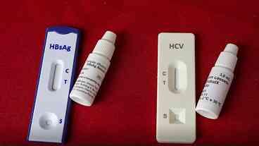 Campanha global alerta para prevenção das hepatites virais
