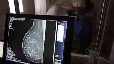 Médicos criam guia para ampliar acesso à mamografia digital