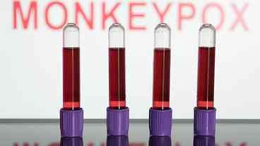 Varíola dos macacos: entenda a transmissão, os sintomas e a vacina