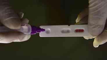 Pesquisadores identificam método capaz de prever gravidade da covid