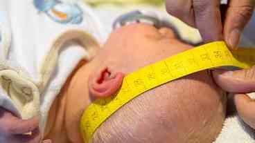 Mortalidade infantil diminui no mundo, diz ONU, taxa no Brasil cai 60%