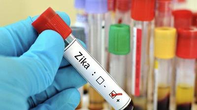 zika-1.jpg