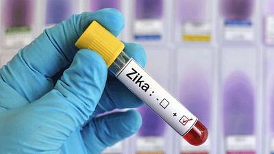 zika-1.jpg
