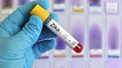 zika.jpg