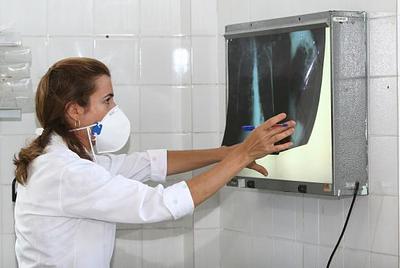 Tuberculosetratamento.jpg