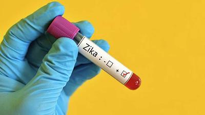 zika-4.jpg