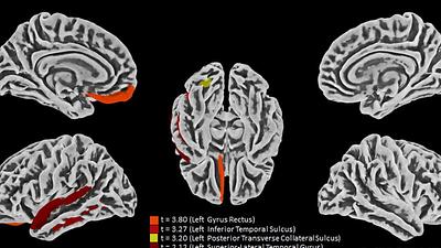 neurologicoscovid.jpeg