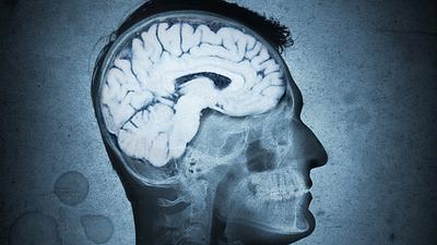 cerebro.jpg