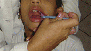 dentes-300x168.gif
