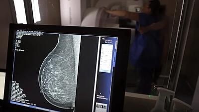 protecaocancermama.jpg