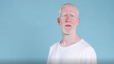 albino.jpg