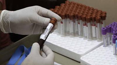 zika-1.jpg