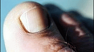 pe-300x168.gif