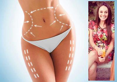 lipo3.jpg