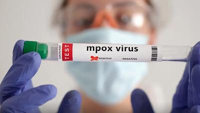 mpox.jpg