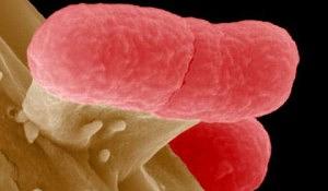 bacteriae-coli-300x175.jpg