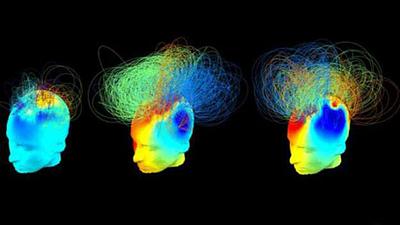 141017120051_brain_624x351_schennu_nocredit.jpg