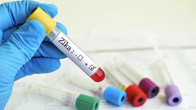 zika.jpg