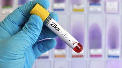 zika.jpg