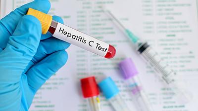 hepatite.jpeg