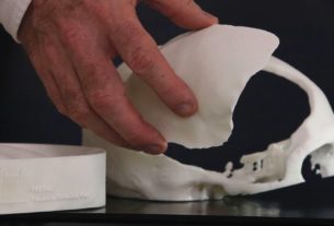 Molde e prótese de cimento ósseo para reconstrução craniana desenvolvida com tecnologia de custos reduzidos